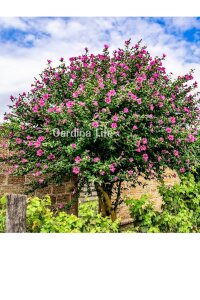 Hatmi  Fide Seti 2 Adet ( Pembe - Beyaz ) - 4